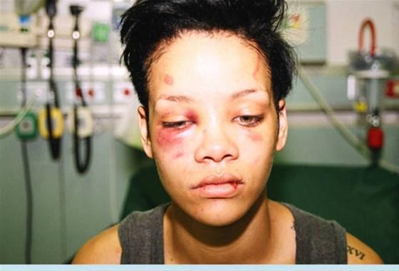 Skandallar kraliçesi Rihanna