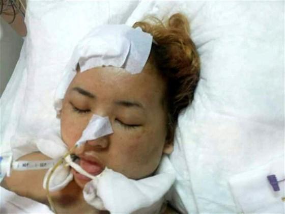 Fuhşa zorlanıp öldüresiye dövülen Kırgız kadın için yardım çağrısı