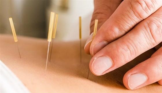 Depresyon için etkili çözüm: Akupunktur