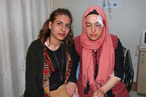 Siirtte AK Partili kadınlara taşlı saldırı: 2 yaralı