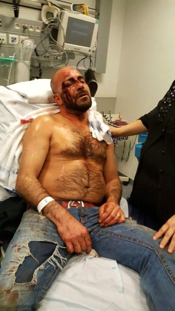 Erdoğancı deyip öldüresiye dövdüler