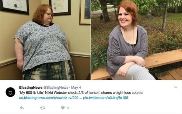 294 kiloluk kadını şimdi gören inanamıyor