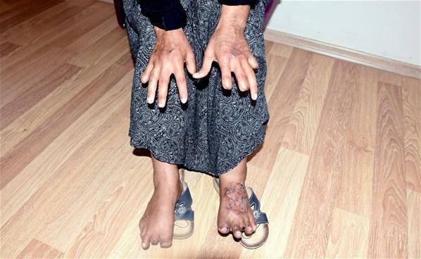 17 yıl boyunca eşinden şiddet gördü 11 parmağı kesildi...