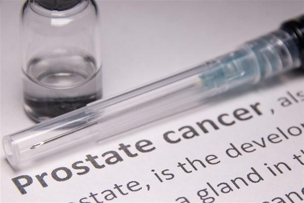 Prostat kanseri tedavisinde akıllı molekül avantajı