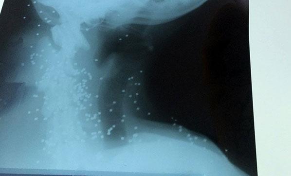 Yaralı köpeğin röntgen filmini görenler şok oldu