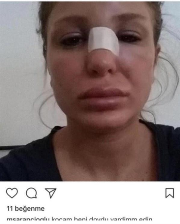 Berk Oktayın eşi: Kocam beni dövdü, yardım edin