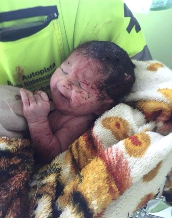 Trafik kazasında hamile kadının karnından bebek fırladı