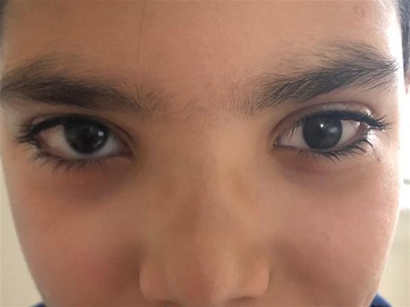 Gözlerini kaybedenler için protez göz tasarlıyor