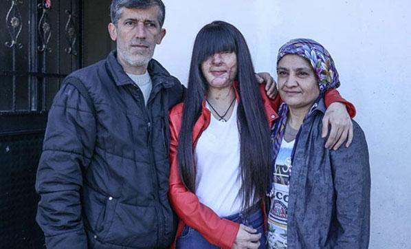 Asitli saldırı mağduru Berfin Özek ve ailesinden Cumhurbaşkanı Erdoğana teşekkür