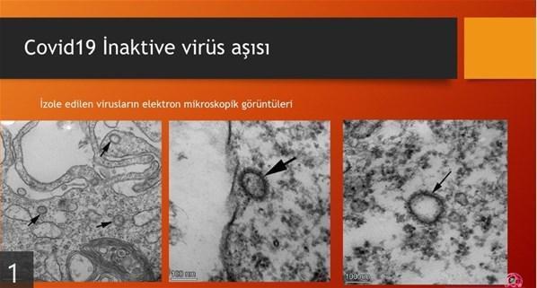 Ercüment Ovalı aşıyı buldu mu Corona virüsü salgını (covid 19) aşısı bulundu mu Prof. Dr. Ercüment Ovalıdan aşı açıklaması