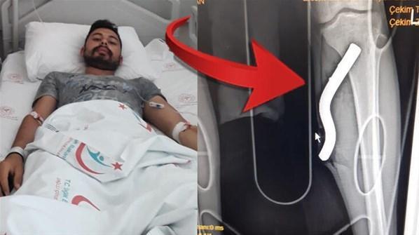 Motosikletin pedalı bacağına saplandı
