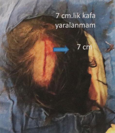 Denizlide kalp cerrahına meslektaşının saldırı anı kamerada