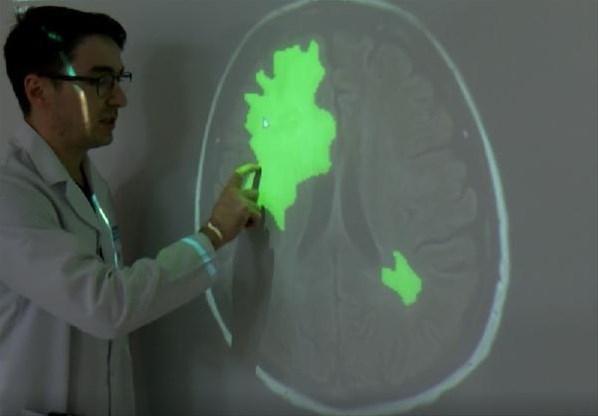 Yapay zeka ile beyin tümörü 5-10 saniyede tespit ediliyor