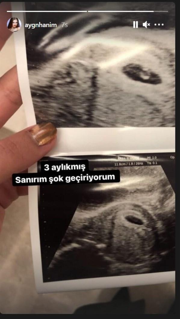 Aygün Aydından hamileyim iması Ultrason görüntüsünü paylaştı: 3 aylıkmış