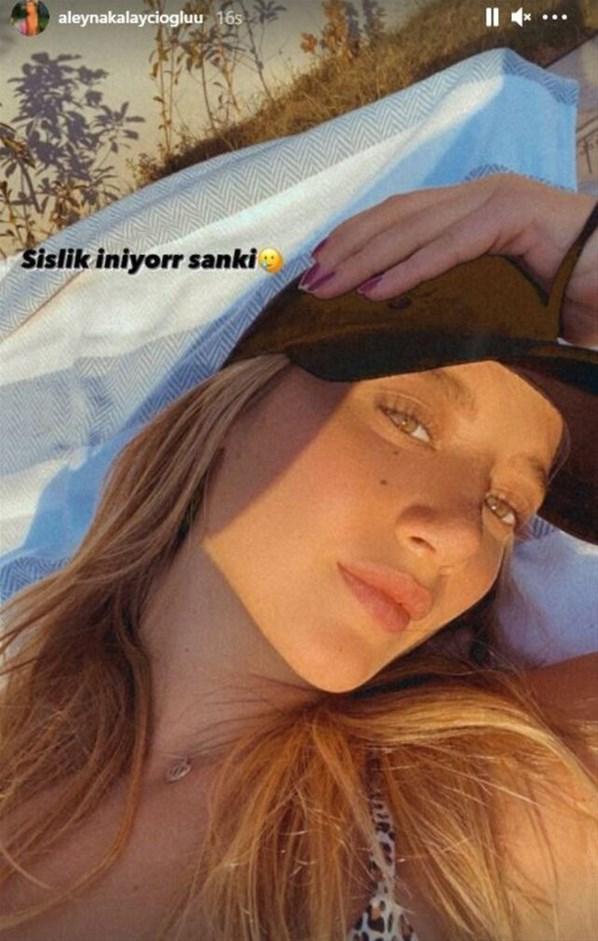 Aleyna Kalaycıoğlunun bandajları çıktı Estetikli hali...