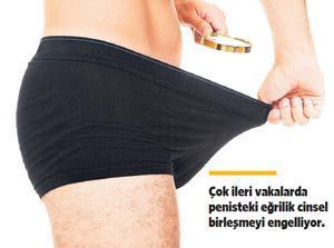 40 yaşı aşanlarda penis eğriliği sıklaşıyor