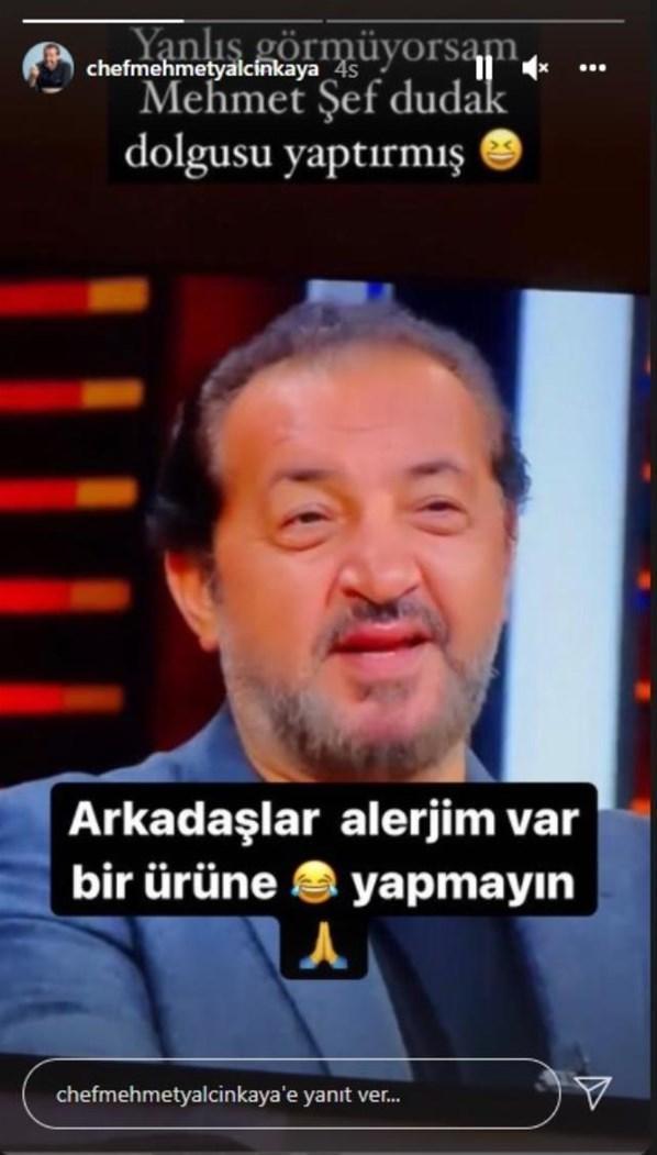 Masterchef Mehmet Yalçınkaya, dudak dolgusu mu yaptırdı