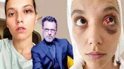 Şiddet iddiasıyla yargılanıyordu!  Ozan Güven için karar verildi
