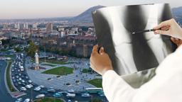 Sivas'ta ortopedi tartışması! 'Sakatlanan Kayseri'nin yolunu tutuyor'