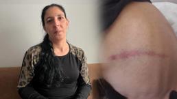 Ölüm tehdidi alan kadının yardım çığlığı: Benim ölmemi mi bekliyor adalet!