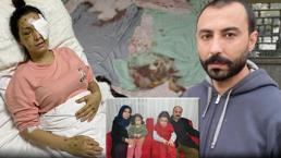 'Ağabey' demeyince dehşet saçtı! Yengesini 37 yerinden bıçaklayıp kör etti