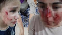 Mardin’de sokak köpekleri dehşet saçtı! Vatandaşların yüzleri parçalandı
