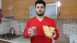Bir yıldır acıkmıyor! Doktorları şaşkına çevirdi