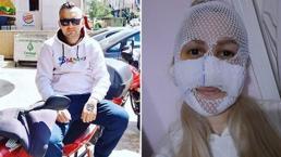 Sultan'ın yüzüne kimyasal madde atan eski sevgili tutuklandı!