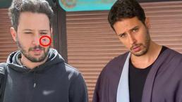 Tuan Tunalı neredeyse gözünden oluyordu! Köpek ısırdı