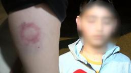 İki kardeş saldırıya uğradı iddiası! 'Annesi beni yerde tutarken çocukla birlikte yumrukluyorlardı'