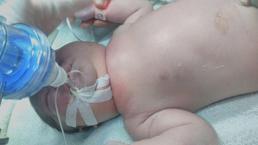 Doğum sırasında bebeğin köprücük kemiğinin kırıldığı iddiası! 'Çocuğu boynundan tutup hırpalıyor'