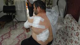 Ayının saldırdığı işçi: Öldüğümü sanıp bıraktı