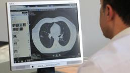 Tekrarlanan öksürük ve nefes darlığına dikkat