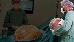 Tam 35 kilo! Karın ağrısıyla gitti, doktorlar şaşkına döndü