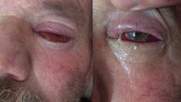 Yer: Trabzon... 'Öldüm, dirildim' 62 yaşında hayatının şokunu yaşadı