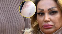 Sahte estetik ve güzellik merkezi skandalı sonrası kritik uyarı! Bunlar yoksa o doktora gitmeyin