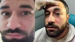 Randevuya geç kalıp, doktoru darbetti! Hasta hakkındaki gerçeği polislerden öğrendi