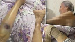 91 yaşındaki kadına bakıcı dehşeti! Yaşlı kadın hastanede ölüm kalım savaşı veriyor
