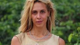 Survivor yarışmacısı Duygu Bal'ın son halini gören inanamıyor!