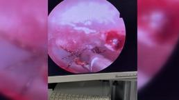 Kulak ağrısıyla hastaneye gitti, korkunç gerçek ortaya çıktı! Uzmanlar uyardı: Artarak devam edecek