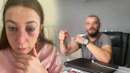 Eski sevgilisi dehşet saçtı! Yüzü tanınmaz hale geldi
