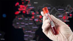 Maymun çiçeği korkusu tüm dünyayı sardı!  Mpox belirtileri neler? 'Maymun Çiçeği'nin anatomisi