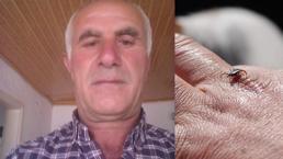Keneyi çıkardı, 4 gün sonra hayatını kaybetti