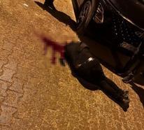Sokakta yürürken tabanca ile başından vuruldu