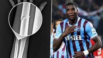 Trabzonspor'da Onuachu şoku! Kolunda kırık tespit edildi