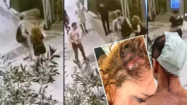 Taksim’de genç çifte çivili sopalı saldırı! Öldüresiye dövdüler