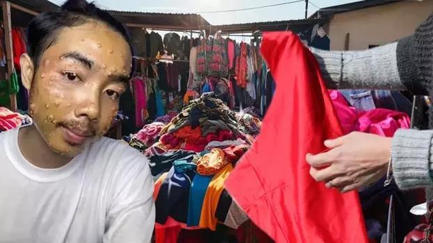 Satın aldığı kıyafeti yıkamadan giydi, hayatı alt üst oldu! Uzmanlar uyardı