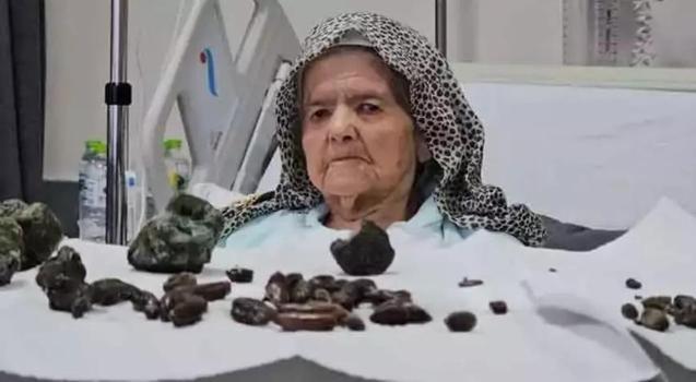 Eşini kaybetti 92 yaşında kızına sığındı! Hastalığını keşfeden doktorlar bile şoke oldu