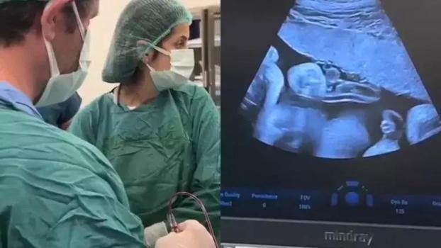 Tıpta nadir görülen operasyon! Anne karnındaki bebeğe kan nakli yapıldı