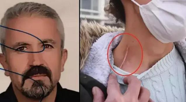 18 bıçak darbesiyle yaraladığı eşin cezası Yargıtay'dan döndü